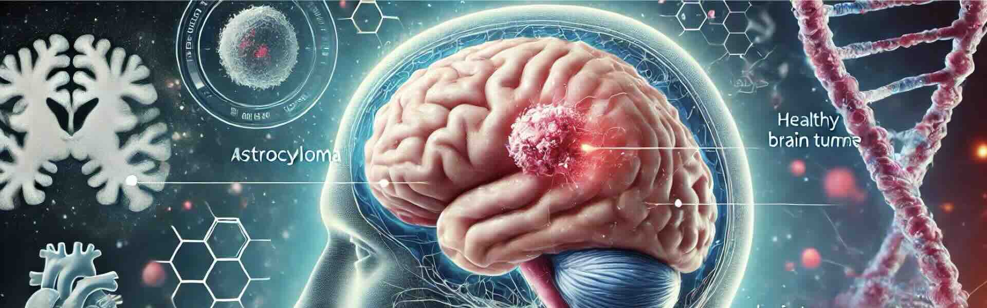 Astrocytoma